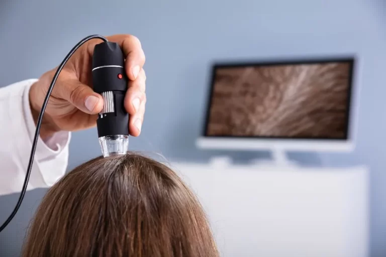 tratamentos-capilares